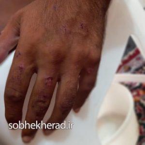 شکنجه عجیب ناتوان ذهنی در گچساران /+تصاویر